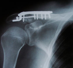 Click here to check out some x-rays!